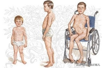 电子女孩营养不良结局_电子女孩营养不良结局翻裙子图片不打吗