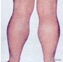 电子女孩营养不良结局_电子女孩营养不良结局翻裙子图片不打吗
